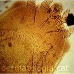 sarcoptesscabiei